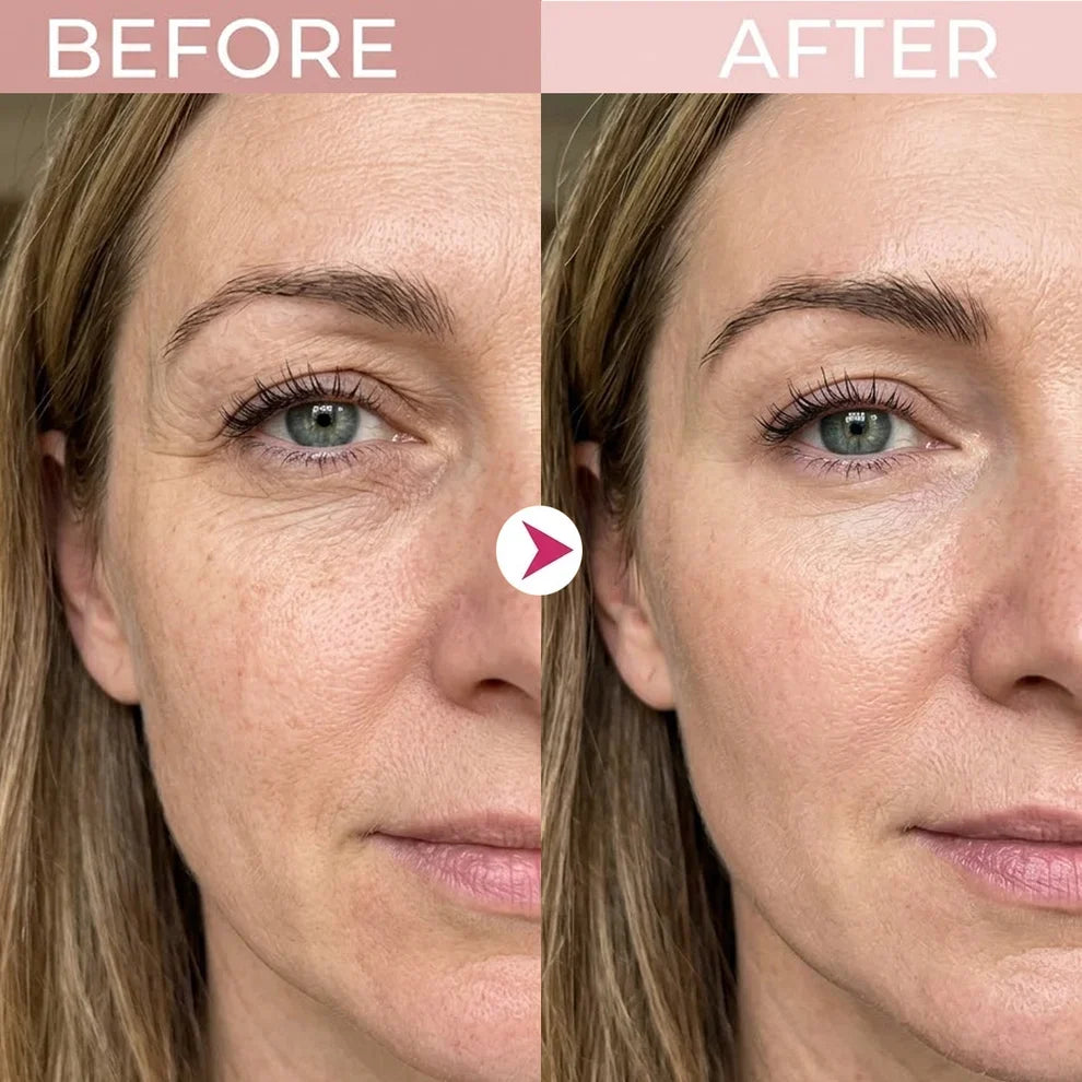 P7 Eye Renewal Cream