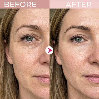 P7 Eye Renewal Cream